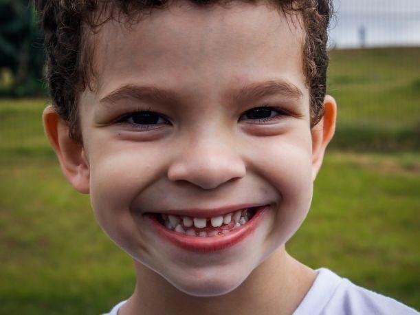 Las secuelas de las caries deterioran la salud