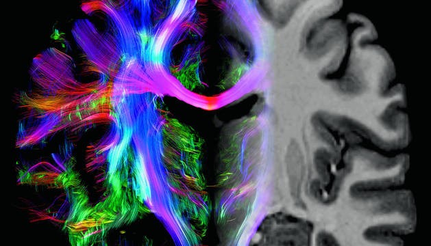 El cerebro mide 150.000 kilómetros