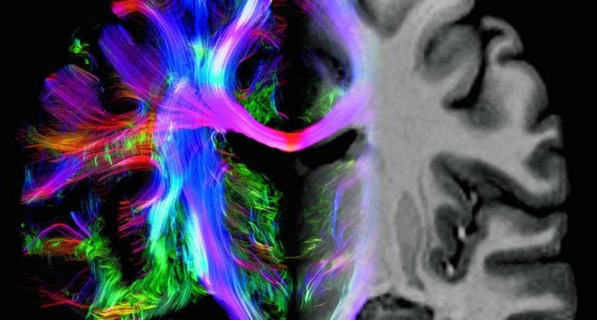 El cerebro mide 150.000 kilómetros